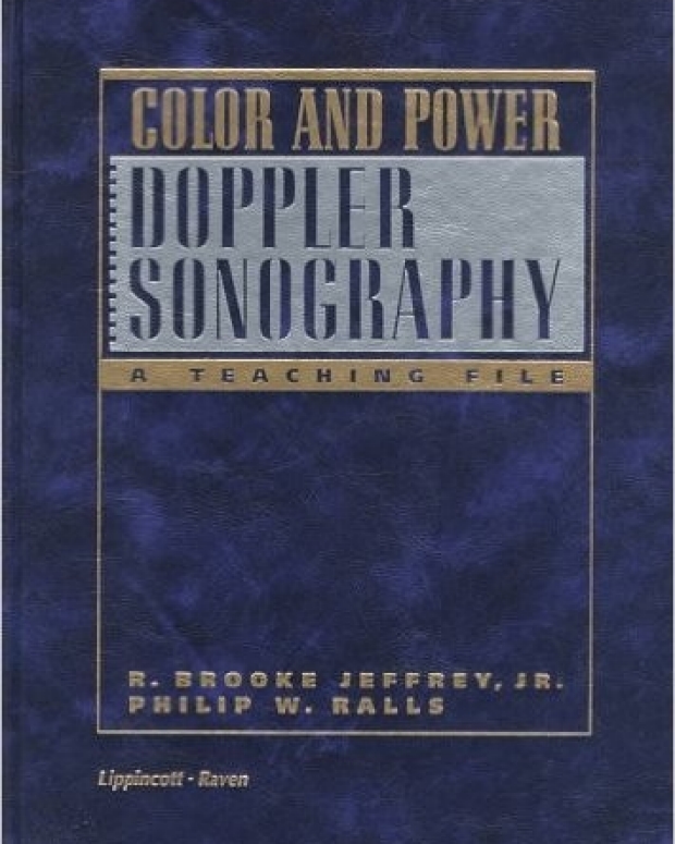 dopple sonography